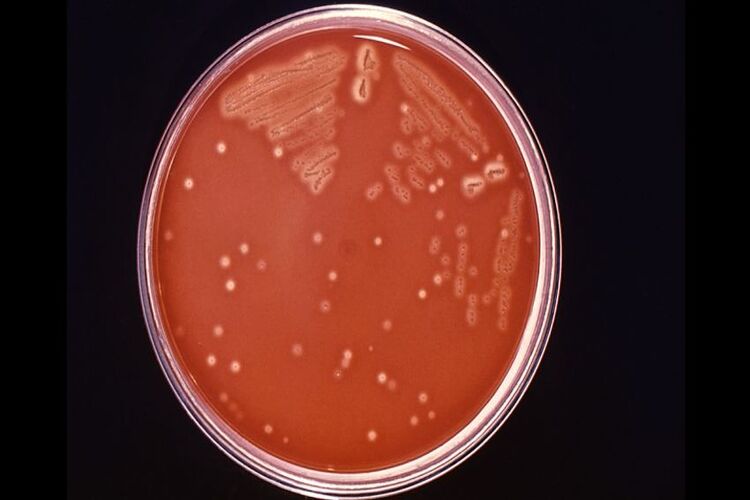 สิ่งที่ต้องรู้เกี่ยวกับแบคทีเรียกินเนื้อ Vibrio vulnificus และวิธีหลีกเลี่ยง